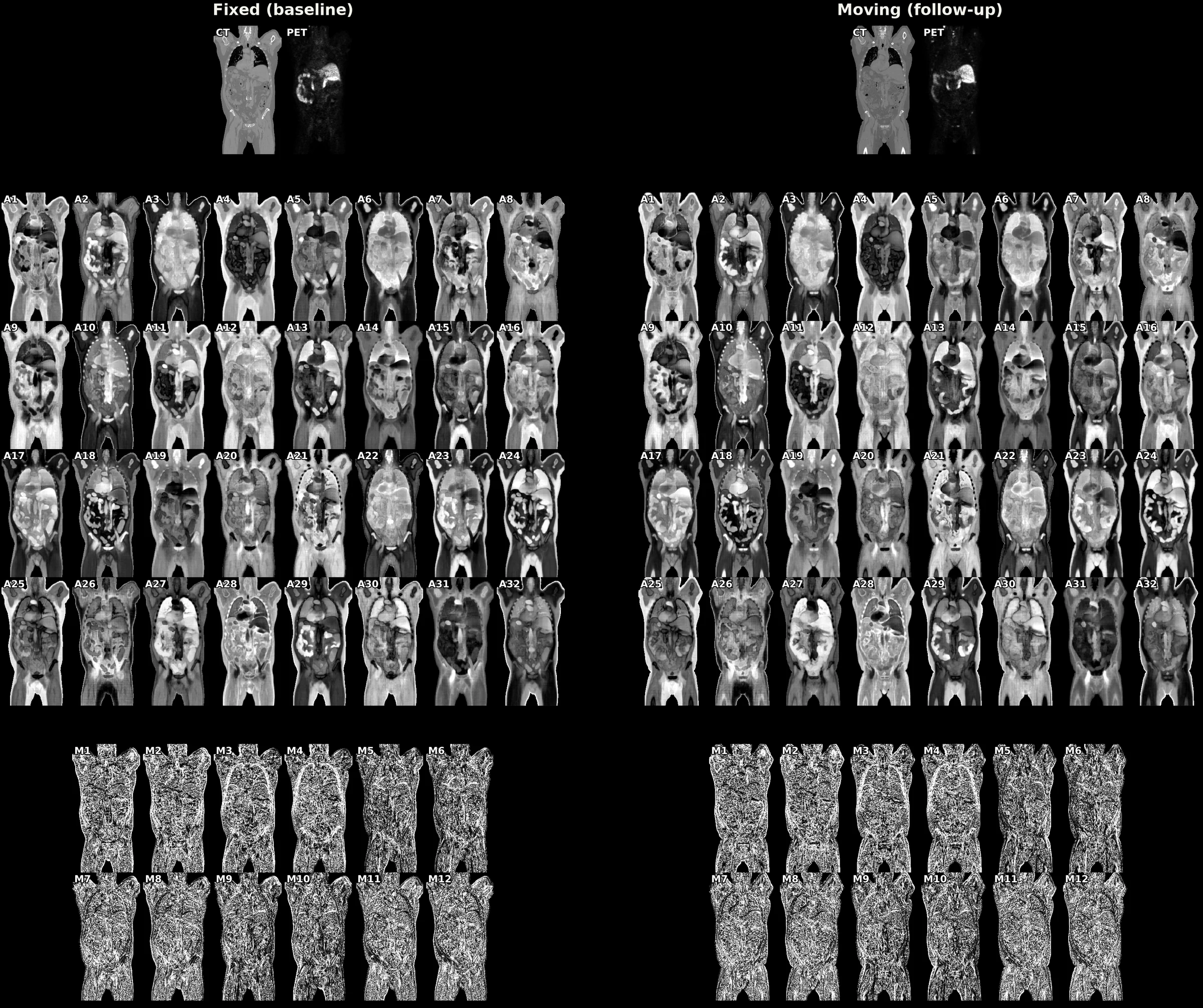 The 46 channels of the Stage-1 feature volume, for the fixed and the moving scan
