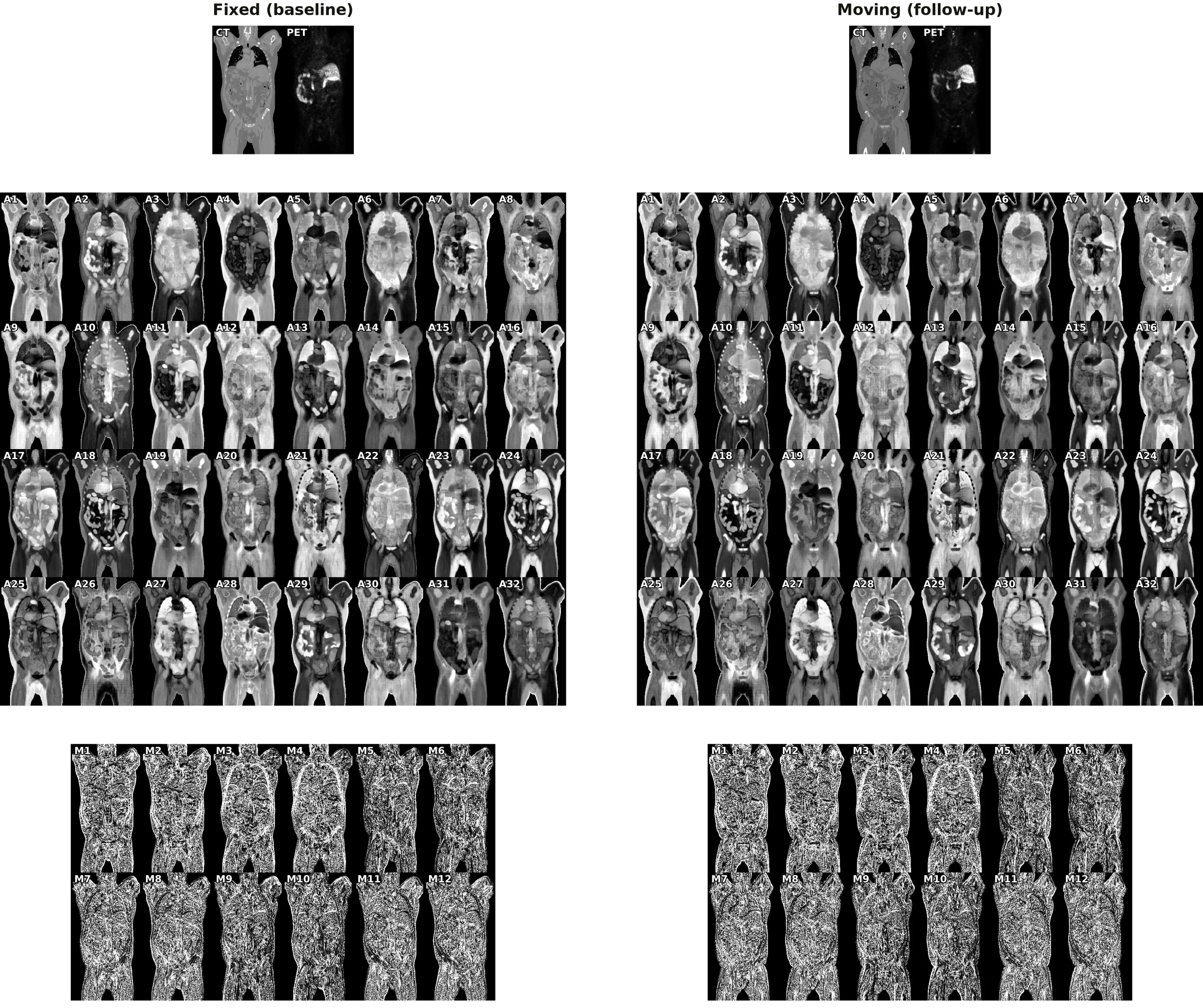 The 46 channels of the Stage-1 feature volume, for the fixed and the moving scan