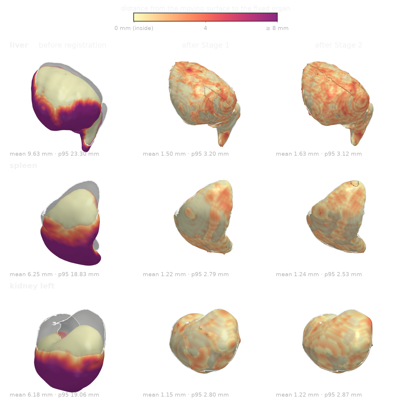 Organ surfaces coloured by distance to the fixed organ, before registration, after Stage 1 and after Stage 2
